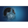Подкрылок CHEVROLET Aveo 2012->,седан, хетчбек (передний правый) - Novline